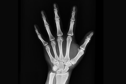 xray.jpg